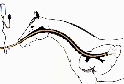 BAL bronko aveolar silikone kateter, Ø 10 mm, L 240 cm, Sterile2